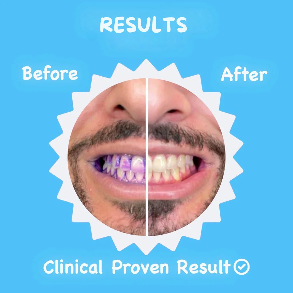 Ultrasonic Toothbrush